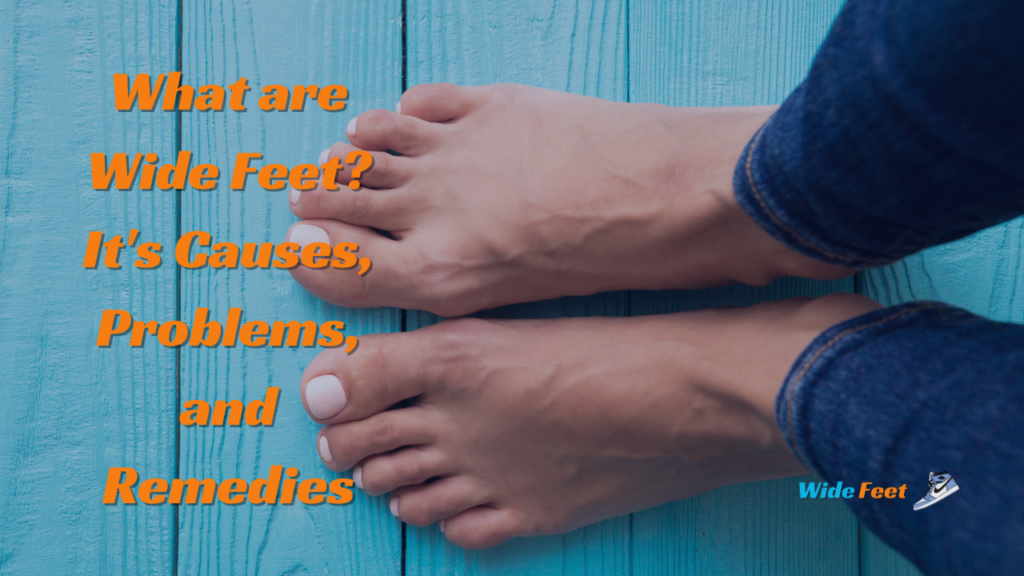 Wide Feet Causes, Problems, and Remedies