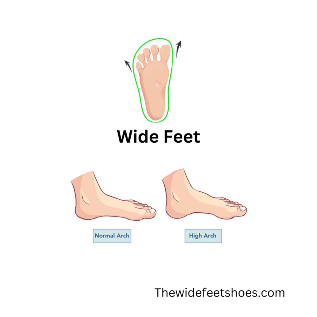 Wide Feet with High Arch 